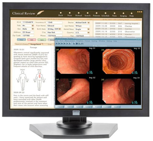 Barco MDRC-2120 21" A